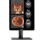 Medical monitor