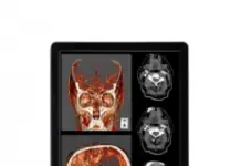 Медицинские мониторы LG, Sony, Nec, сравнительная таблица